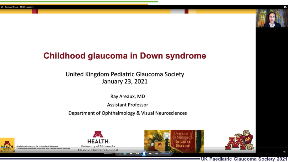 23 - Raymond G Areaux Jr. - Childhood glaucoma in Down syndrome
